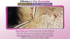 What is Rapid Harvest and Early Implantation Technique