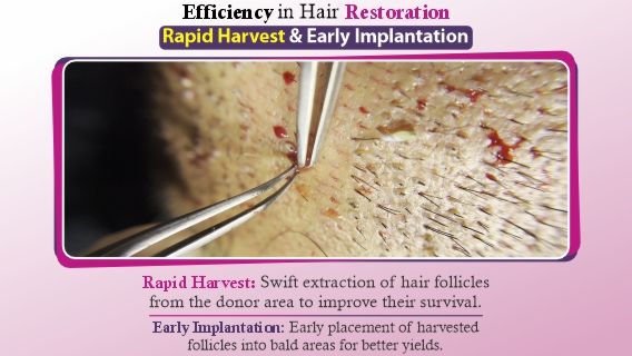What is Rapid Harvest And Early Implantation Technique