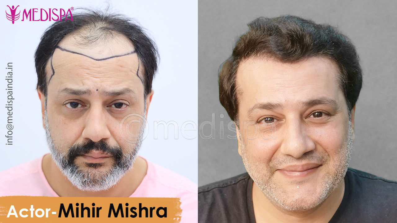 best Celebrity actor Mihir Mishra result