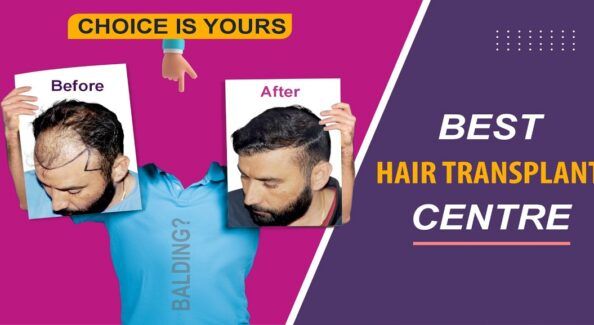 How To Get Painless Hair Transplant Treatment With Best Results?