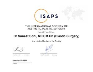 ispas hair transplant india