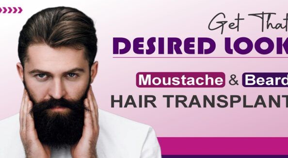Everything To Need To Know About Beard Hair Transplant