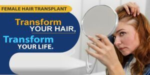 How To Overcome Female Pattern Baldness By Hair Restoration?