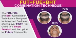 Why FUE+FUT+BHT Combine Method is Preferred For Hair Transplantation?