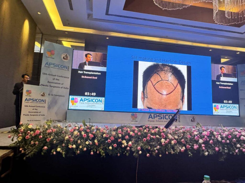hair transplant surgeon india