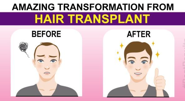 Explain The Scientific Ways Of Performing Hair Restoration