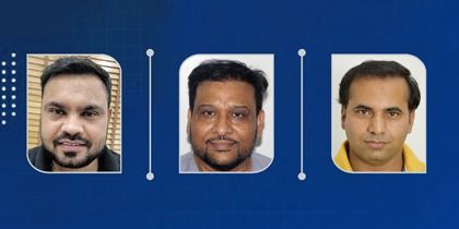 hair transplant india