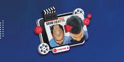 hair transplant cost