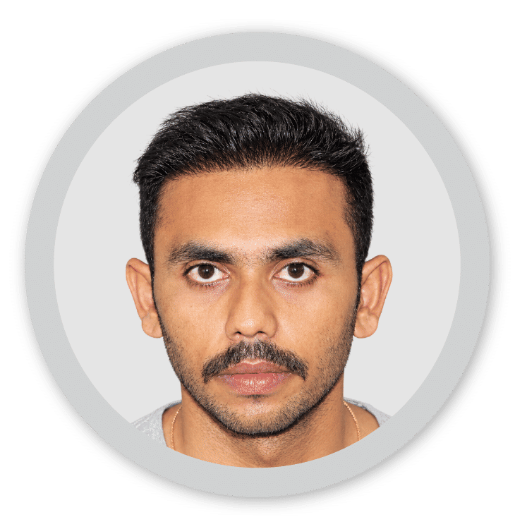 wrong hair transplant correction jaipur
