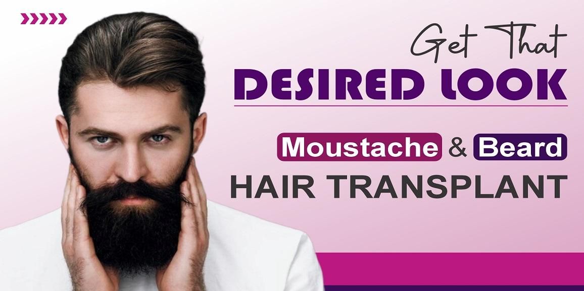 Everything You Need To Know About Beard Hair Transplant