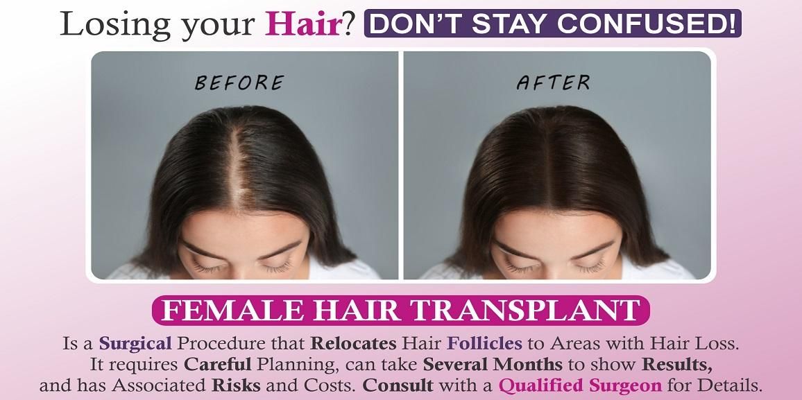 Explain Hair Loss in Women And How To Get Over it With Hair Transplant?