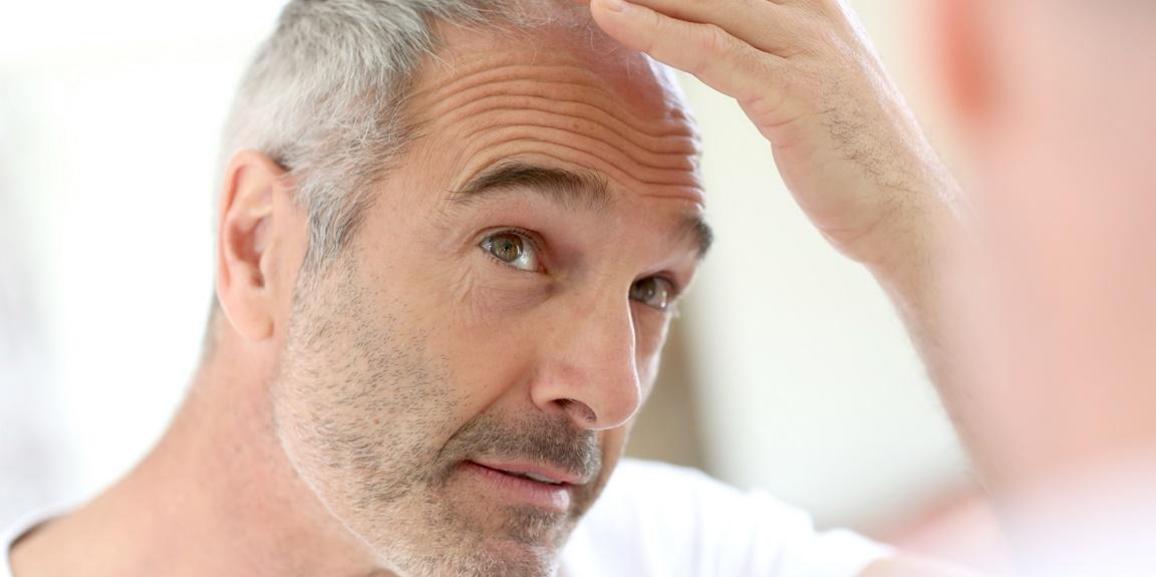 WHY INDIA IS THE FAVOURITE DESTINATION FOR PEOPLE SEEKING HAIR TRANSPLANTATION