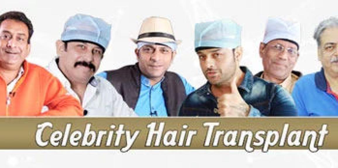 The Ultimate Guide To Celebrity Hair Transplant in India