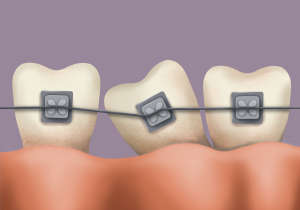 Paediatric Dentistry and Orthodontics
