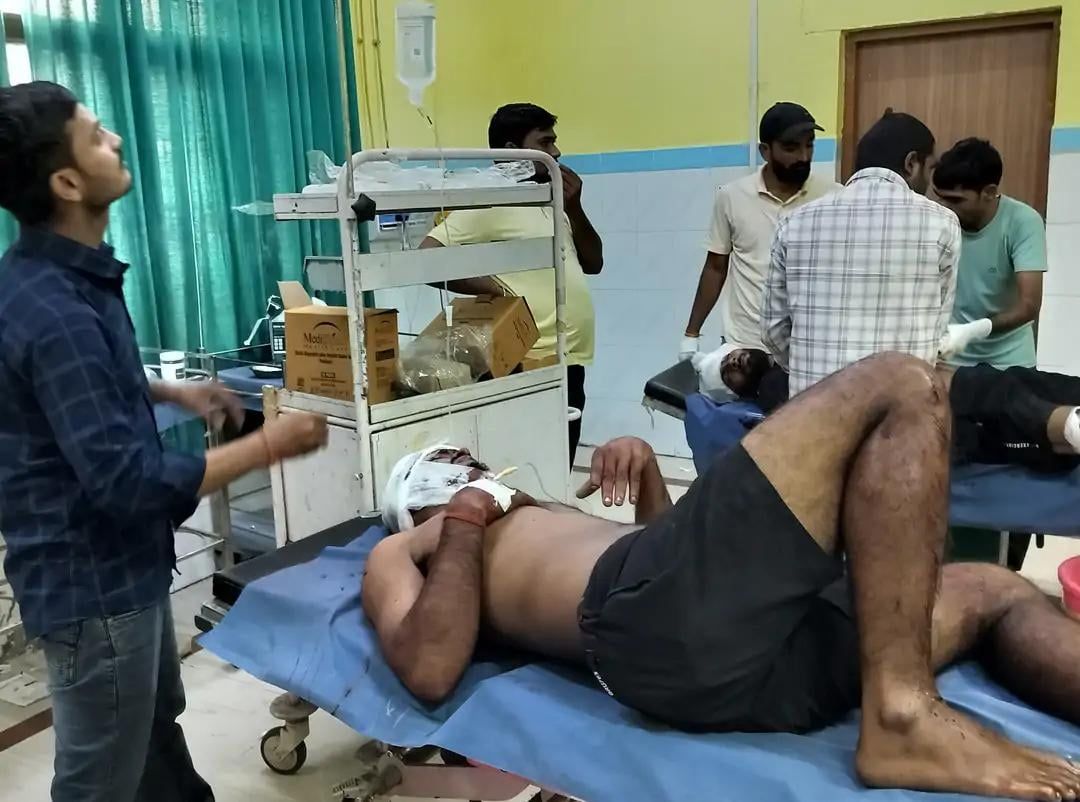 यूपीः सुलतानपुर में गोकशी के आरोपियों से पुलिस की मुठभेड़, दो गिरफ्तार