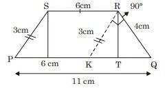 Explanation Figure 1