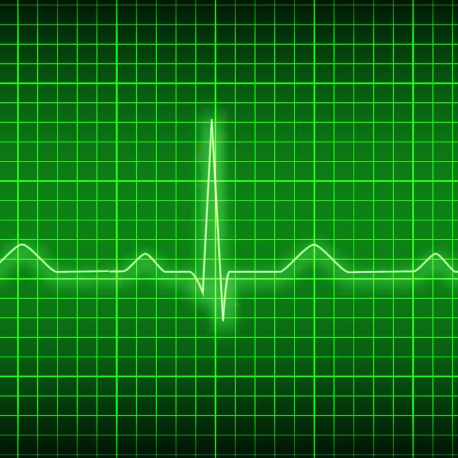 Electrocardiograma, cardiología, signos vitales, cardio