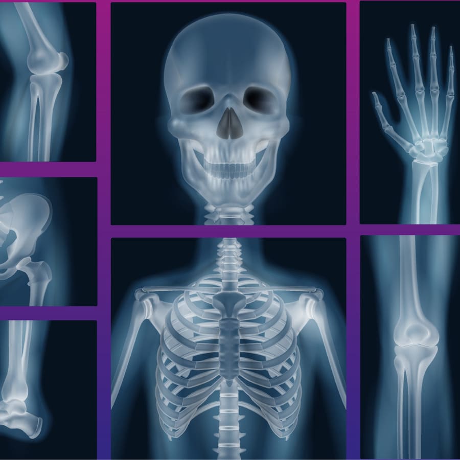 Radiografía ósea, cráneo, manos, pies, rodilla