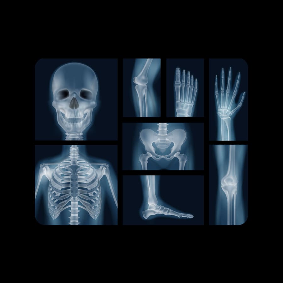 Radiología
