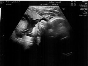 baby-week-35