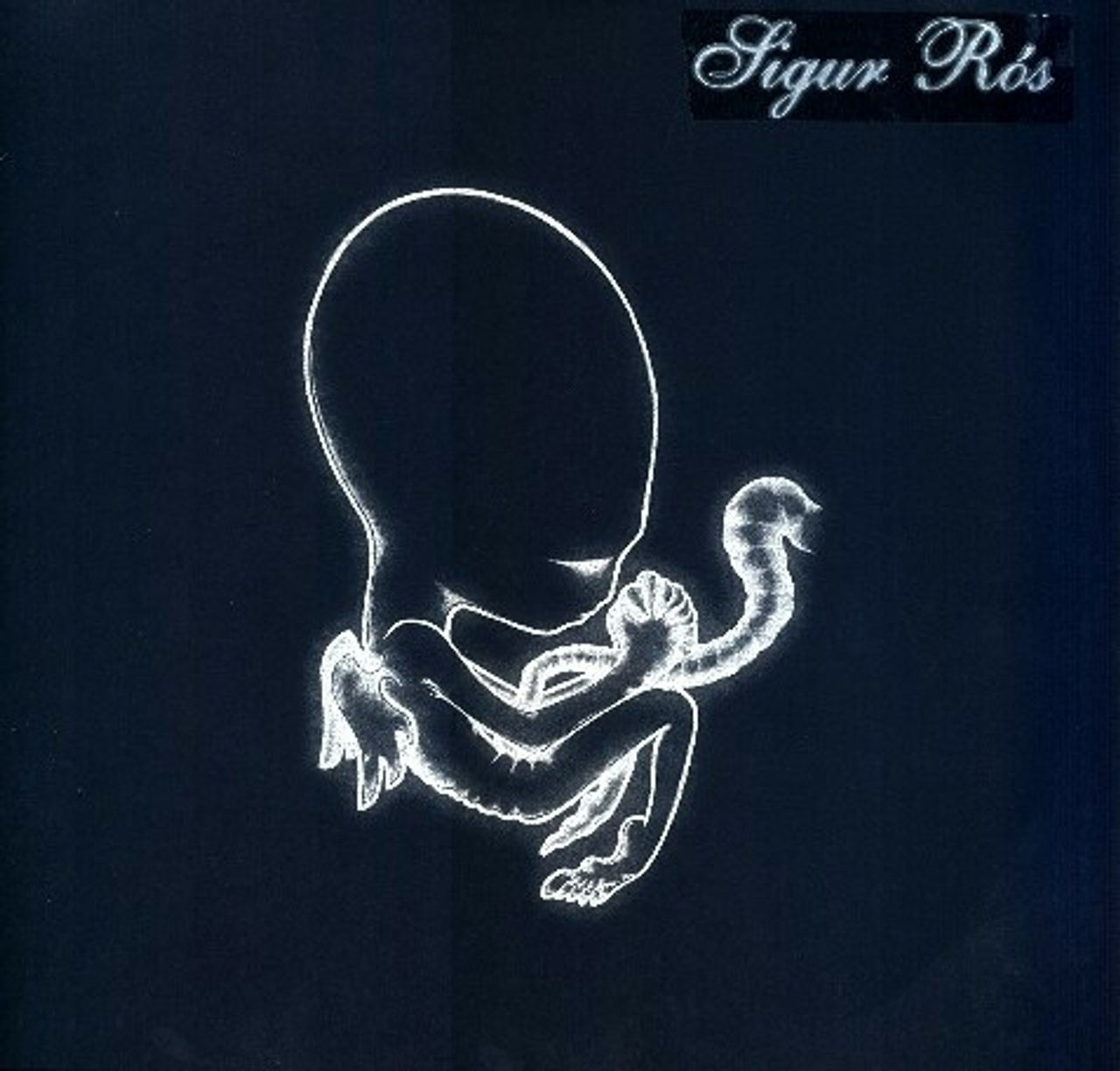 Sigur Ros