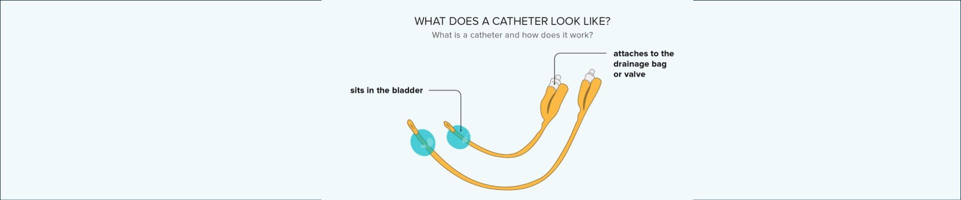 Dialysis Catheter Archives - Meditech Devices