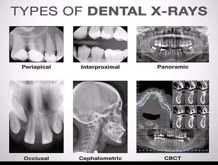 Did you know? Not all dental x-rays are created equal. – Britten Perio