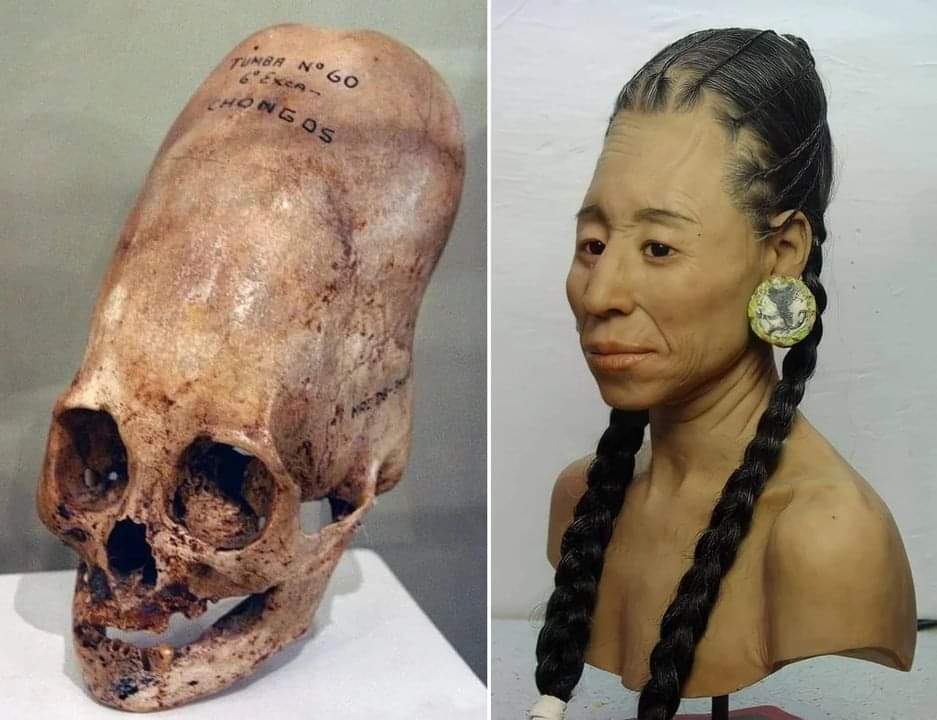 In 1928, numerous elongated skulls were unearthed at the Paracas Peninsula in Peru. The Paracas civi