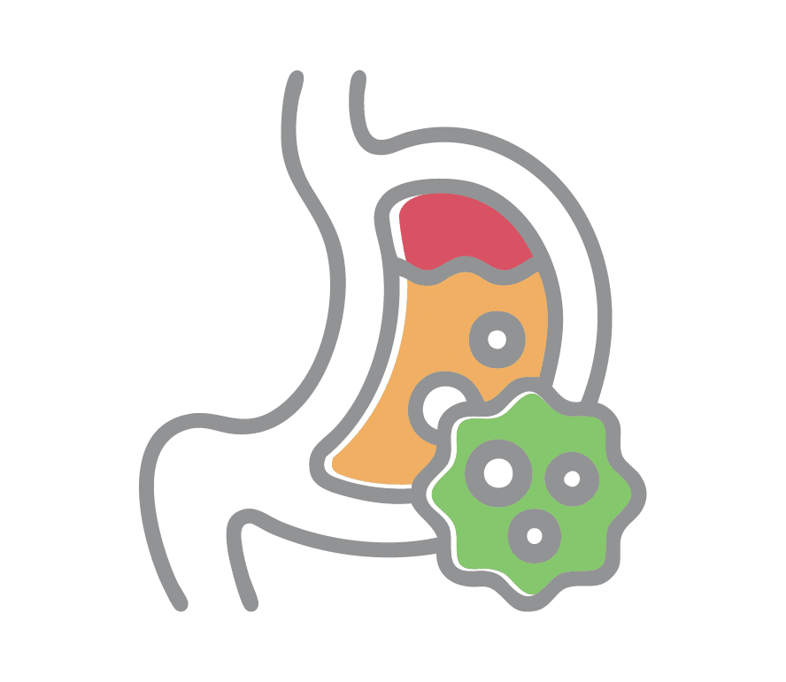 Stomach Cancer