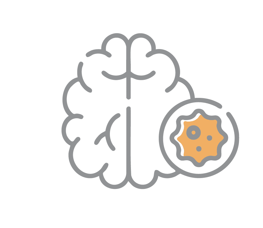 Brain Cancer