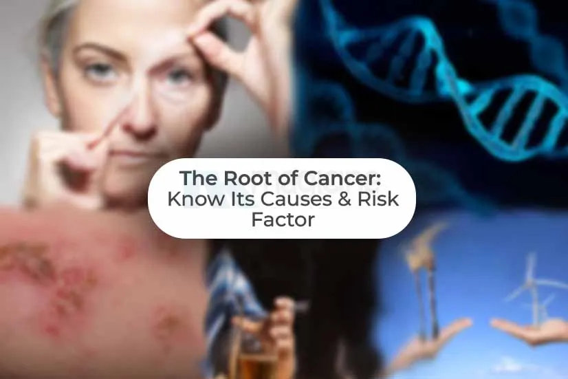 The Roots of Cancer: Know Its Causes and Risk Factor The Roots of Cancer: Know Its Causes and Risk Factor