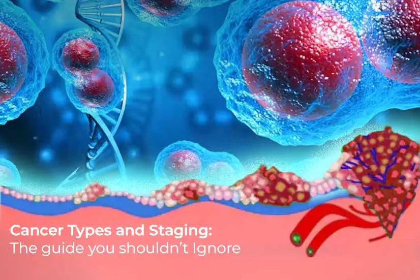 Cancer Types and Staging: The guide you shouldn’t ignore Cancer Types and Staging: The guide you shouldn’t ignore