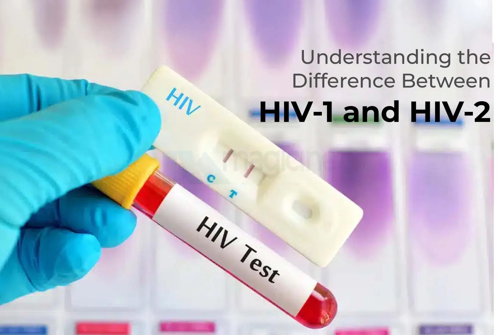 Understanding the Difference Between HIV-1 and HIV-2 Understanding the Difference Between HIV-1 and HIV-2
