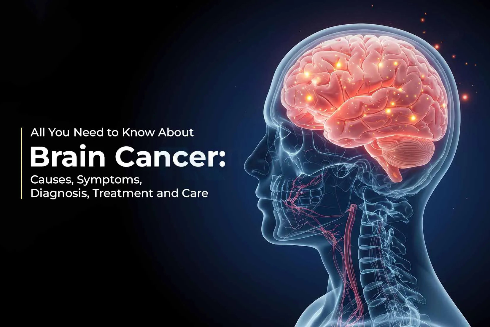 All You Need to Know About Brain Cancer: Causes, Symptoms, Diagnosis, Treatment and Care All You Need to Know About Brain Cancer: Causes, Symptoms, Diagnosis, Treatment and Care