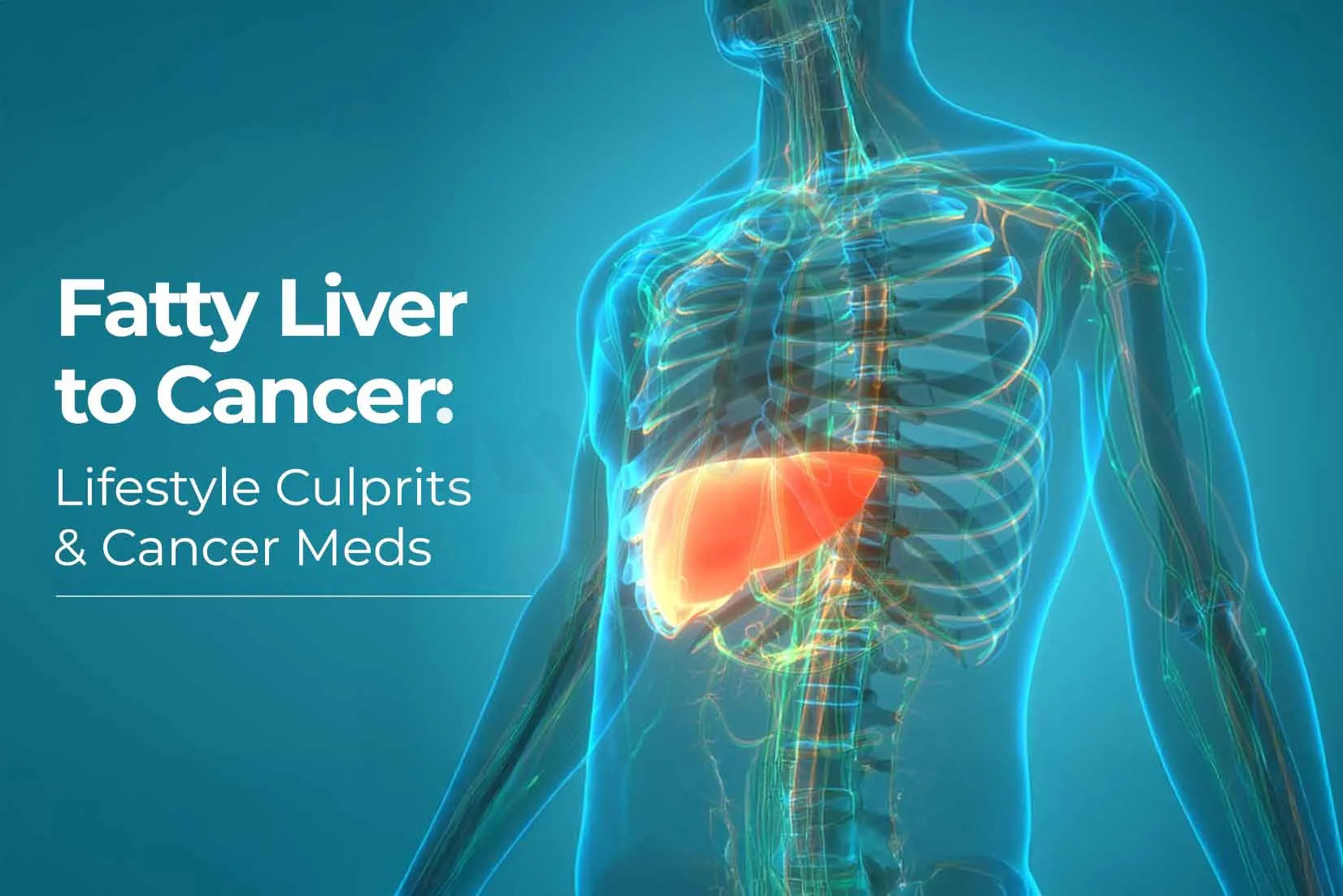 Progression From Fatty Liver to Liver Cancer