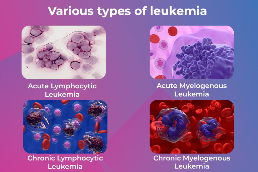 Various types of leukemia