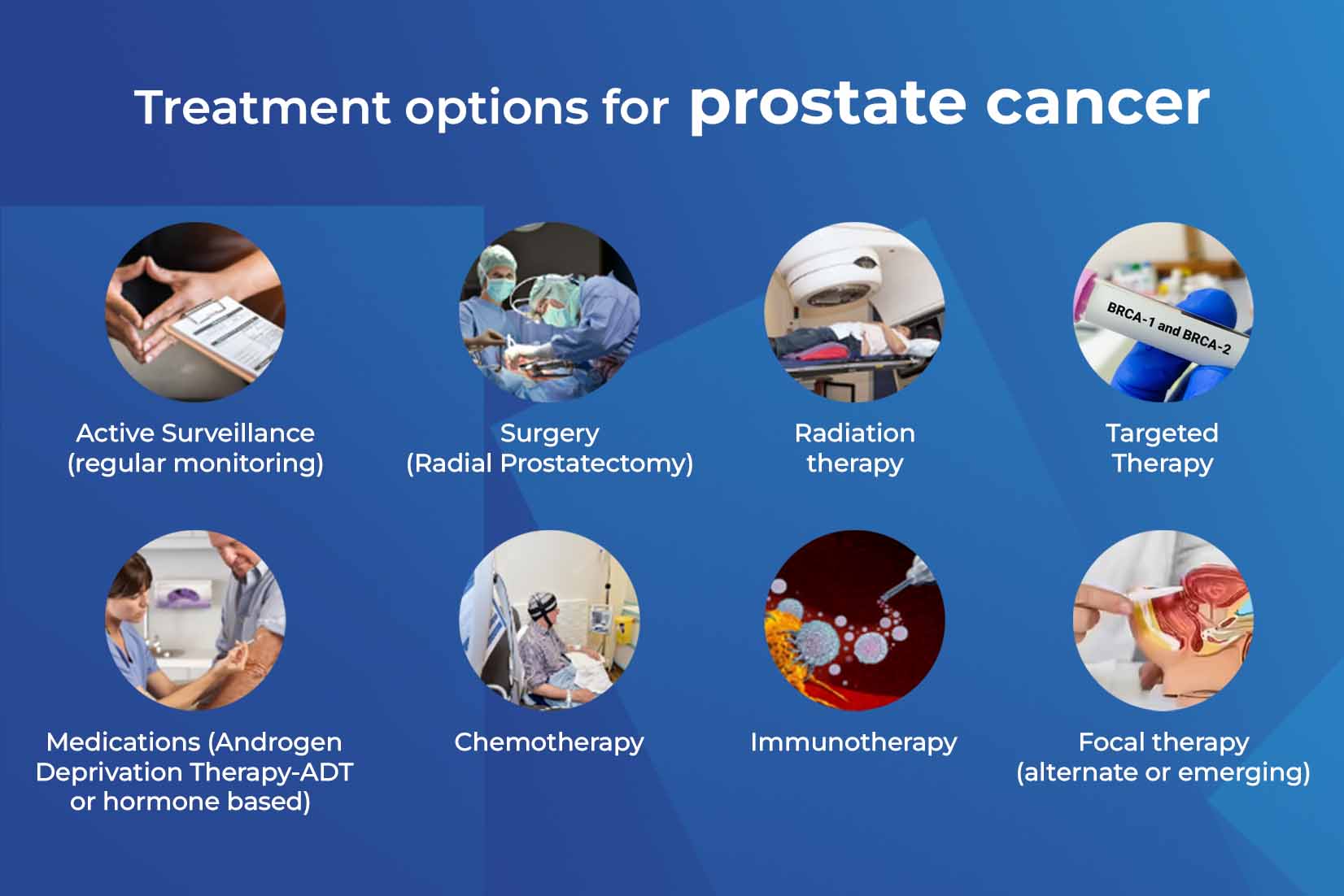 Prostate Cancer Treatment Options Available