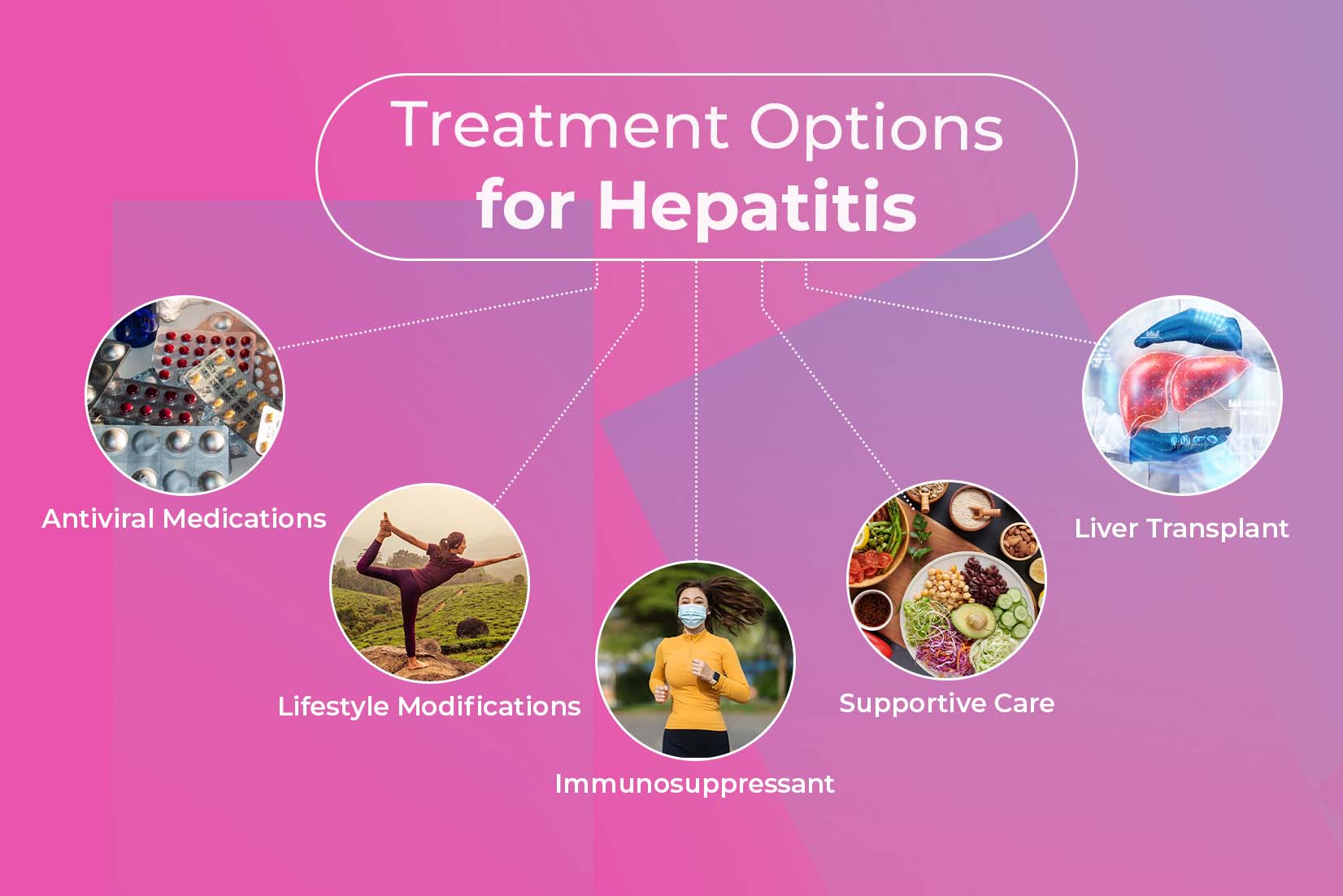 Treatment Options for Hepatitis