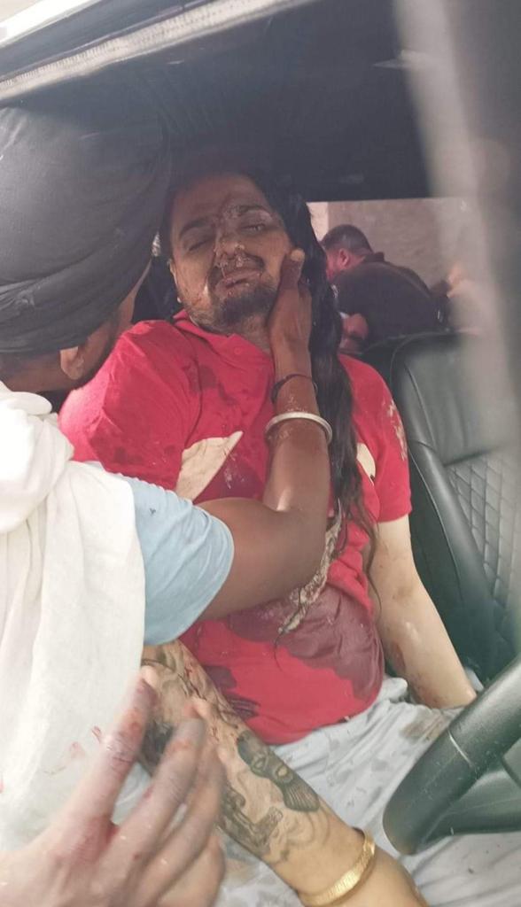 सुरक्षा हटाए जाने के एक दिन बाद पंजाबी गायक सिद्धू मूसेवाला वाला की गोली मारकर हत्या 3 bbb 3