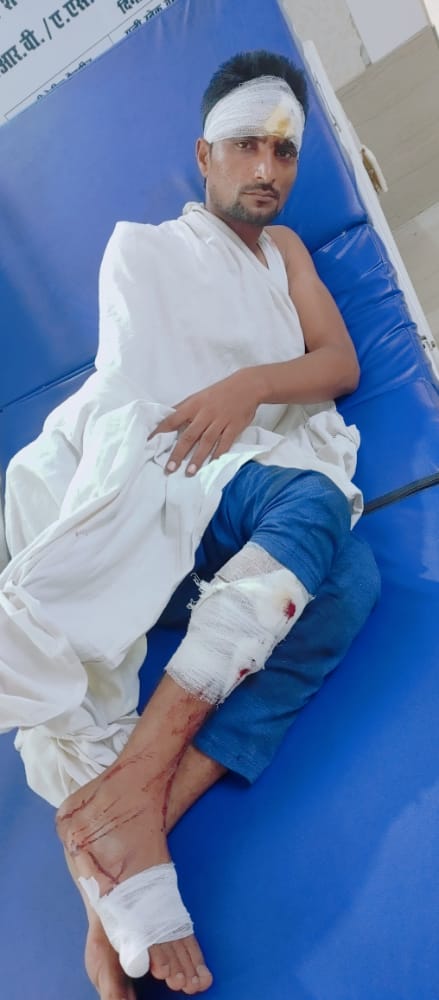 प्रधान और पूर्व प्रधान समर्थकों में फायरिंग गोली लगने से 2 लोग गंभीर रूप से घायल हथियार लहराने के वीडियो भी सामने आए हैं 3 114 16