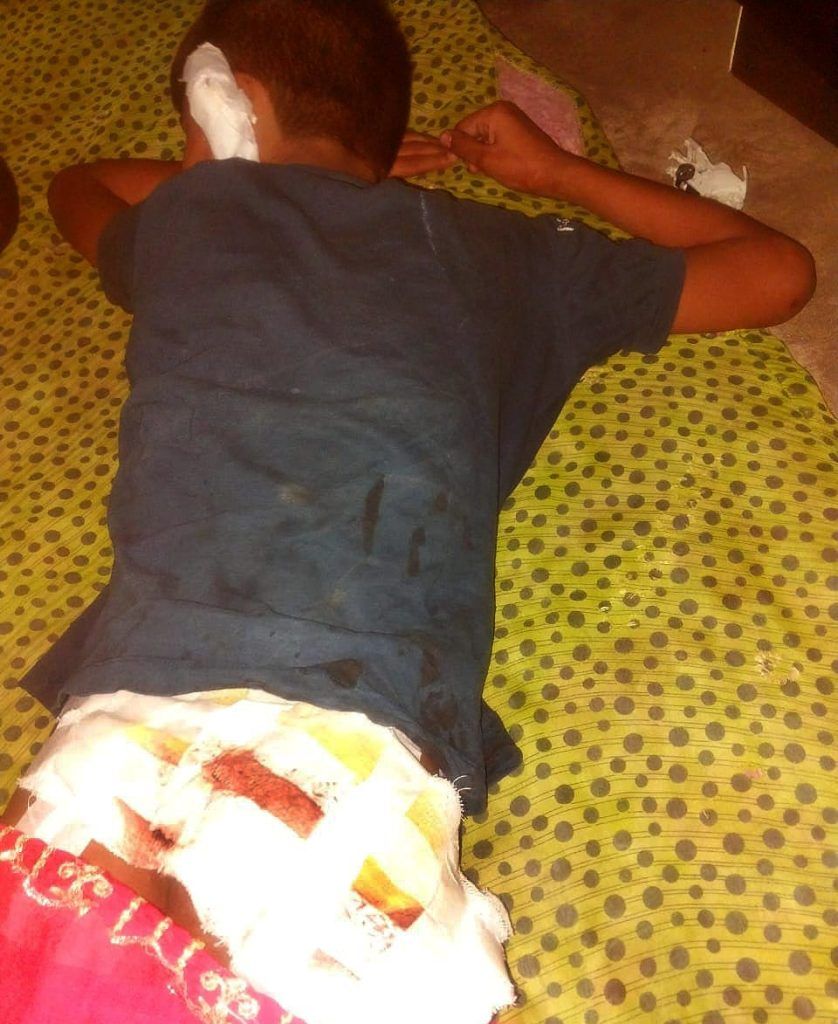 Young Boy Brutally Attacked by Pet Pit Bull: Ghaziabad Residents Demand Stricter Regulations 4 111 39