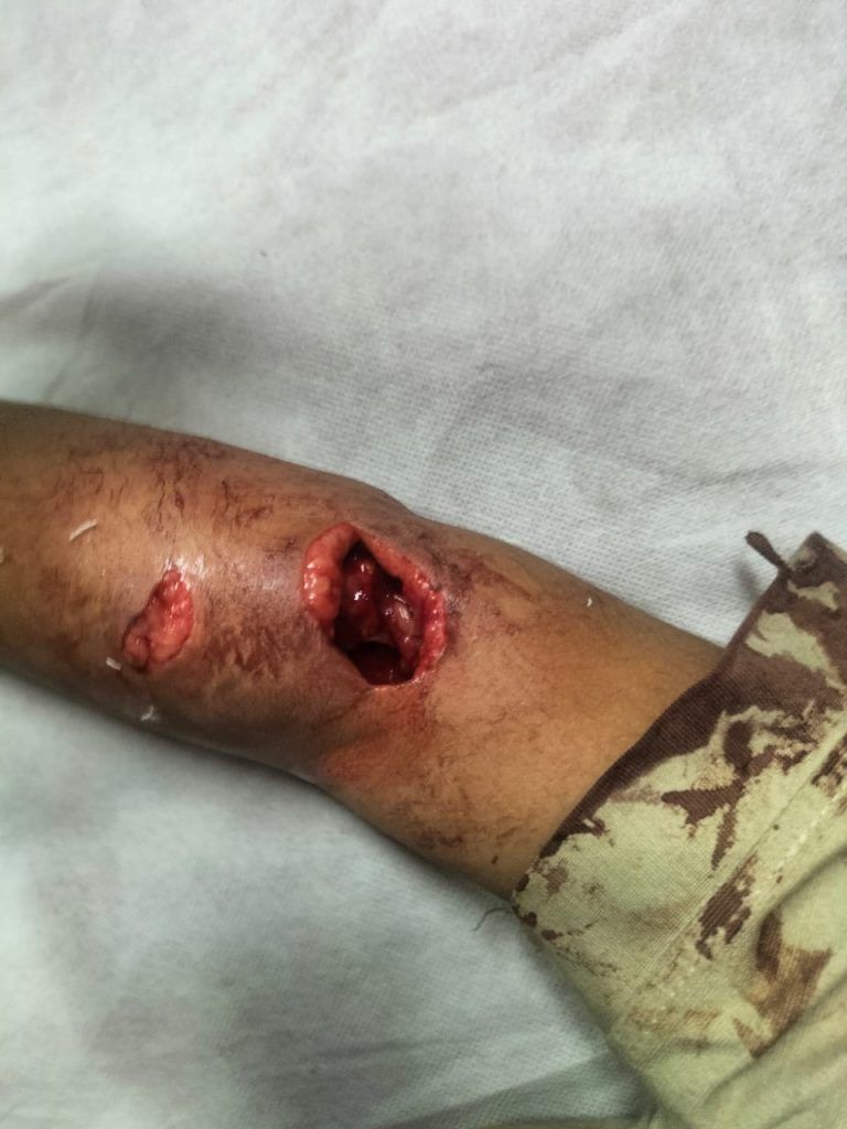 4-Year-Old Boy Injured in Terrifying Monkey Attack in Mussoorie Village 2 111 14