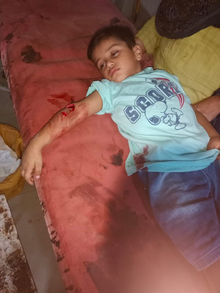 4-Year-Old Boy Injured in Terrifying Monkey Attack in Mussoorie Village 3 112 9