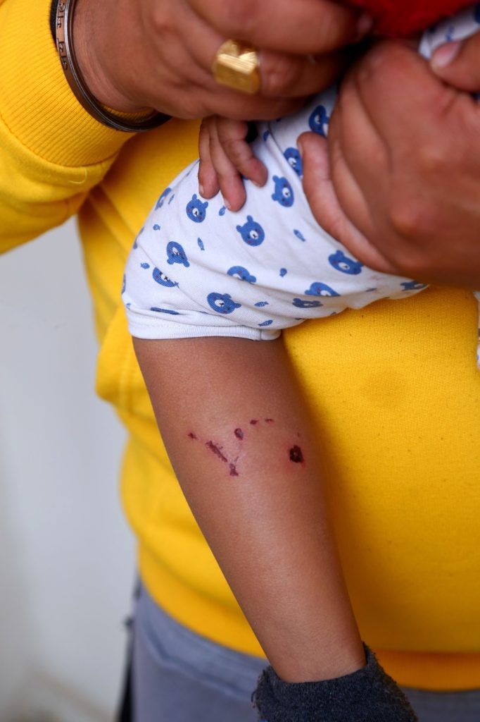 गाजियाबाद में बेकाबू कुत्तों का आतंक; ढाई साल के बच्चे पर झुंड में किया हमला 2 112 67