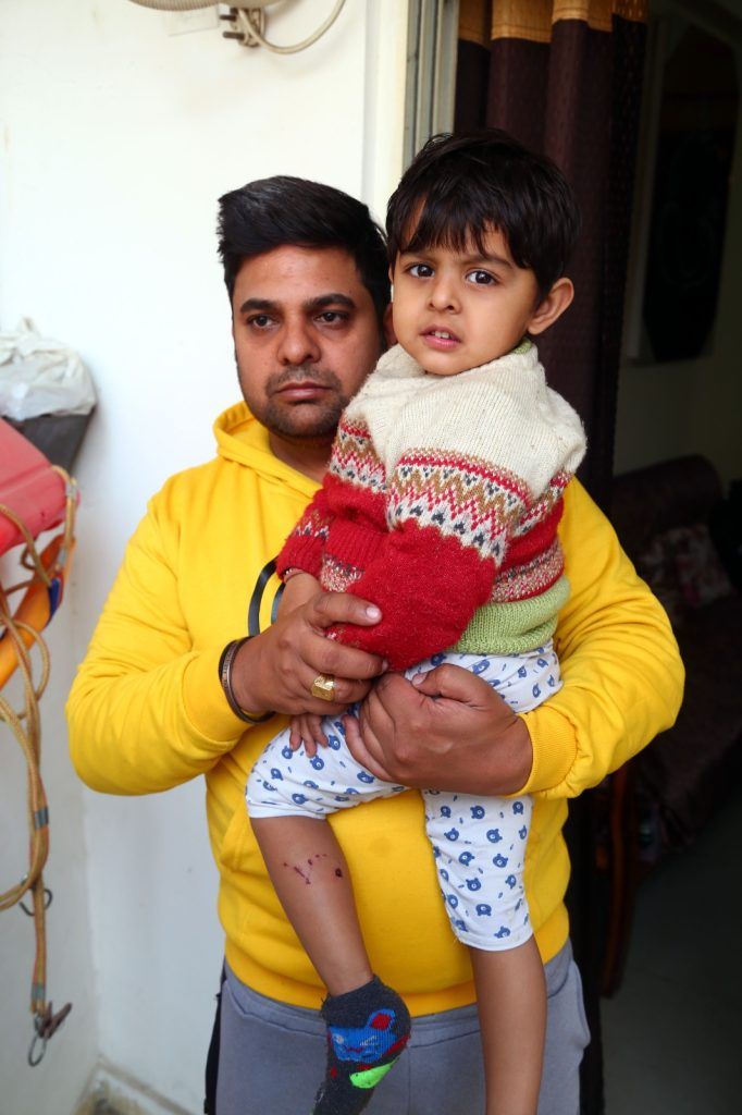 गाजियाबाद में बेकाबू कुत्तों का आतंक; ढाई साल के बच्चे पर झुंड में किया हमला 3 113 57