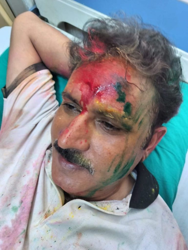 Flat Owners Federation President Attacked by Stray Dogs in Raj Nagar Extension 1 111 9