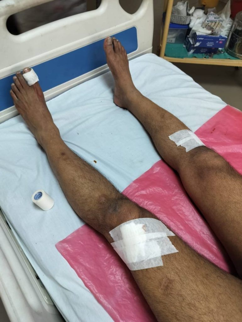 Flat Owners Federation President Attacked by Stray Dogs in Raj Nagar Extension 2 112 6