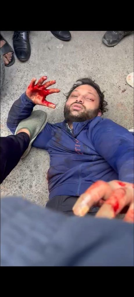 मोदीनगर में सर्राफा कारोबारी की हत्या, हमलावर मौके पर ही भीड़ ने दबोचा - व्यापारियों में आक्रोश 2 112 3