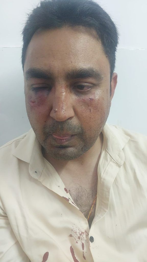 रामा हाइट्स सोसायटी में विवाद ने पकड़ा तूल, एओए पदाधिकारियों पर हमले के आरोप 1 511 9