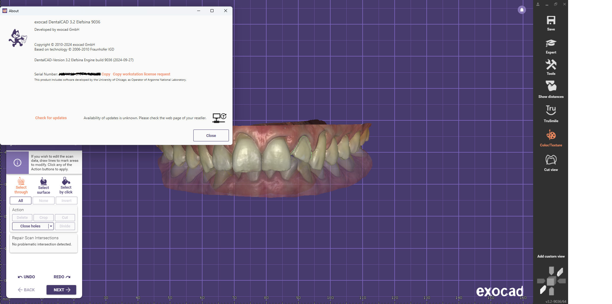 Working with EXOCAD Elefsina 3.2 Build 9036 full activated